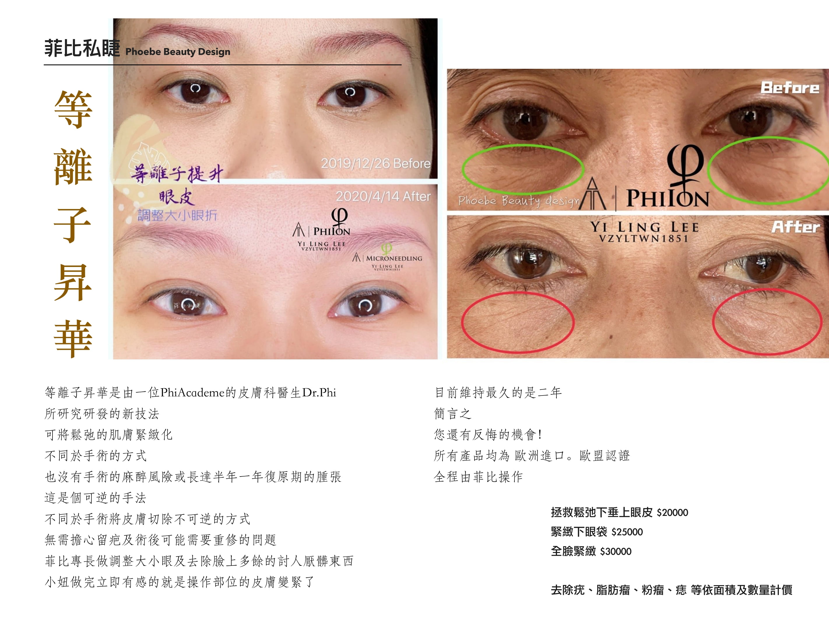 改善肌膚鬆弛/解救鬆弛雙眼皮介紹及價錢